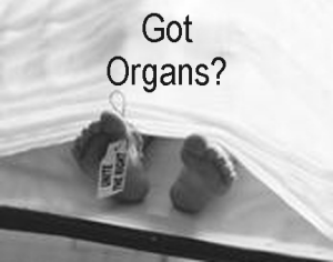 Got Organs?